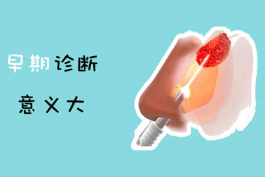 科普|著名导演因鼻咽癌去世，这项检查一定要做！